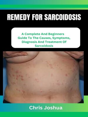 cover image of REMEDY FOR SARCOIDOSIS